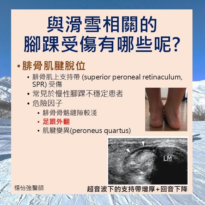 雙板腳踝傷害