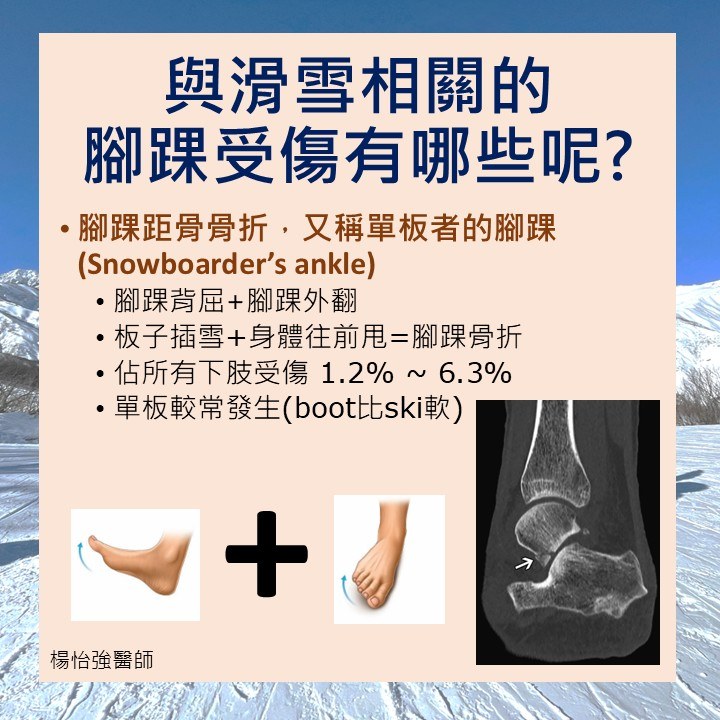 單板腳踝傷害類型
