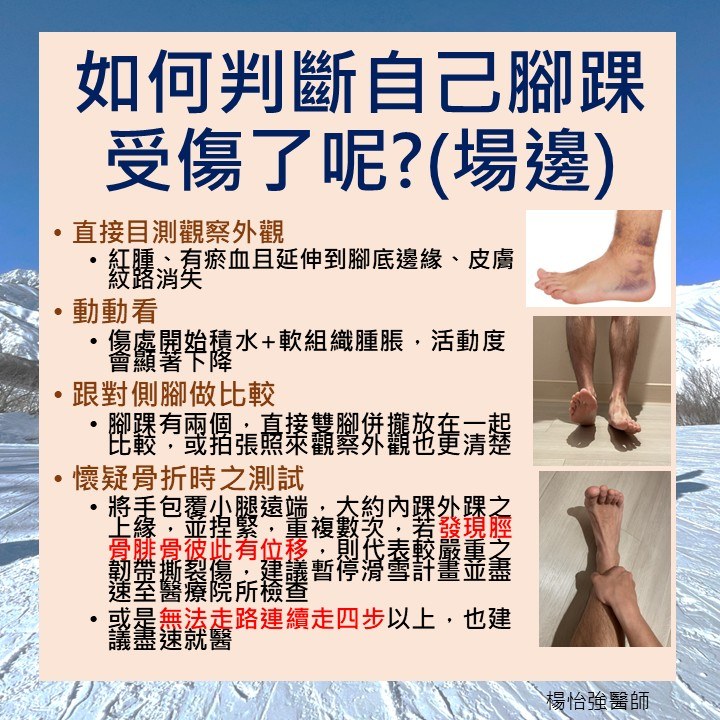 Snowboarder Ankle 距骨外側突骨折